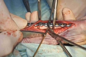 猫　脛腓骨粉砕骨折　手術9