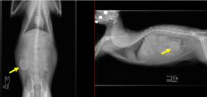 重複腸管レントゲン画像