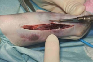 猫　脛腓骨粉砕骨折　手術1